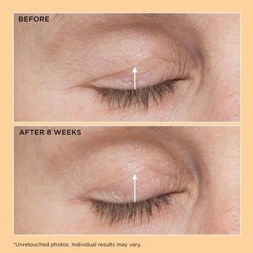 Perricone MD Лифтинг сыворотка для кожи вокруг глаз Neuropeptide Eyelid Lift Serum