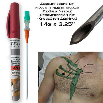 Декомпрессионая игла DekIgla Needle Decompression Kit КровеСтоп 14gx3.25"