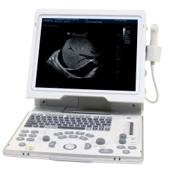 Аппарат УЗИ (сканер) Mindray DP-50