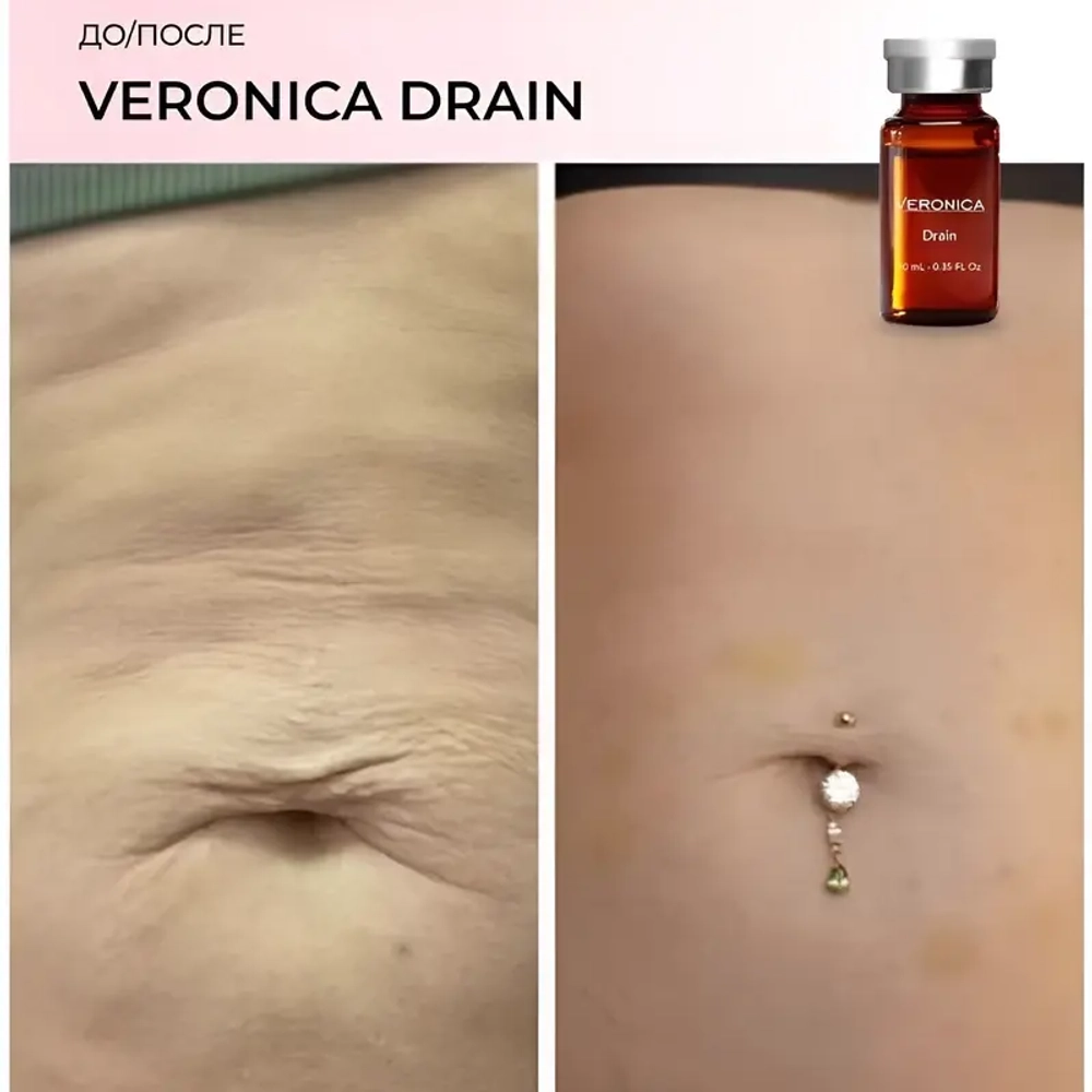 Drain Veronica