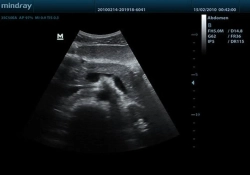 Аппарат УЗИ (сканер) Mindray DP-50