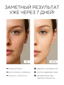 МЯГКИЙ КРЕМ-ГЕЛЬ ДЛЯ УМЫВАНИЯ С САЛИЦИЛОВОЙ КИСЛОТОЙ 0,5%