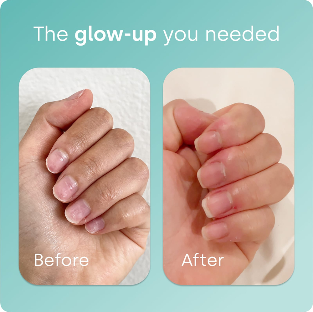 Biosil, Advanced Collagen Generator®, средство для стимулирования производства коллагена, 120 оригинальных капсул