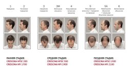 Crescina HFI Hair Follicular Islands RE-GROWTH 1700 Лосьон для стимуляции роста волос, для мужчин (40 ампул по 3,5 мл)