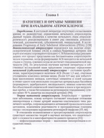 Начальный атеросклероз: факторы риска, диагностика, профилактика, лечение