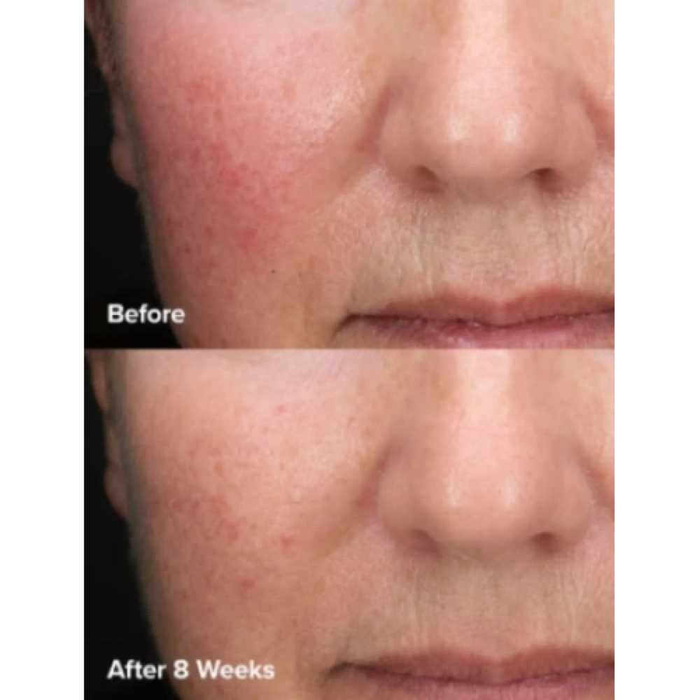 Paula's Choice 6% Mandelic Acid + 2% Lactic Acid Liquid Exfoliant 88ml