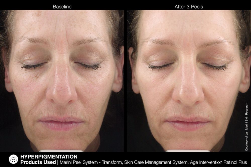 JAN MARINI AGE INTERVENTION RETINOL+ 0,5% Крем-акселератор с ретинолом 0,5% для борьбы с видимыми возрастными изменениями