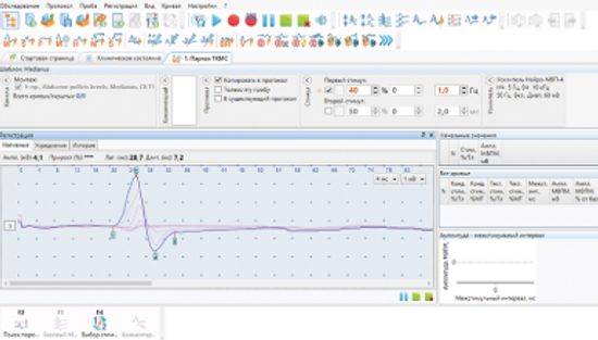 НЕЙРО-МС МОНОФАЗНЫЙ (для парной стимуляции)