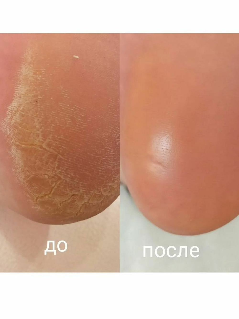 Пилинг носочки для ног педикюрные маска отшелушивающая 1 шт