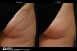 Jan Marini MARINI CELLULITX Высокоэффективный антицеллюлитный крем.  Объем: 114 мл