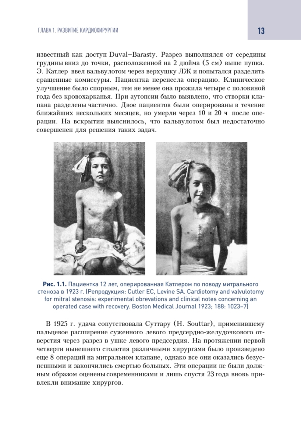 Кардиохирургический минимум для кардиологов