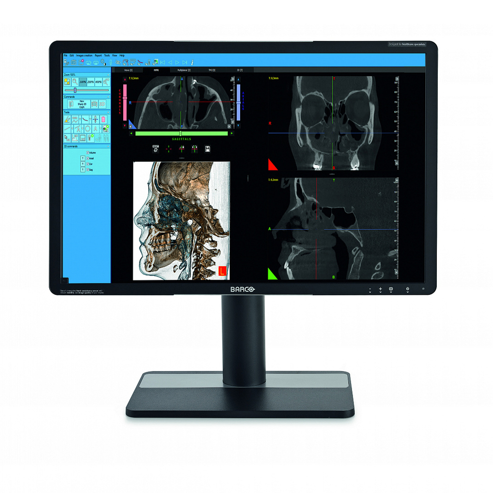 Стоматологический томограф NewTom HR Professional (16x18)