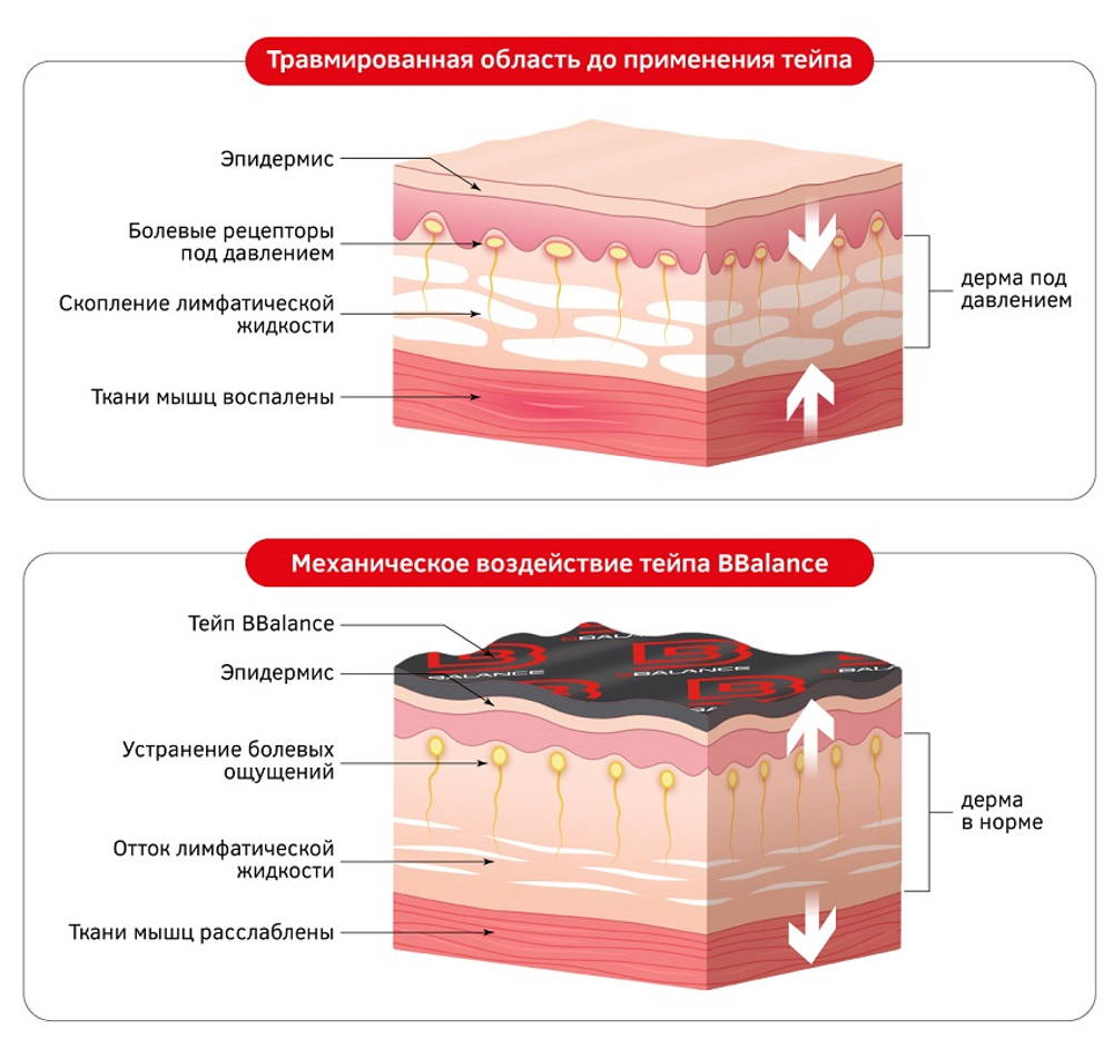 Кинезио тейп BBTape 2,5см*5м FACE PACK ICE SILK