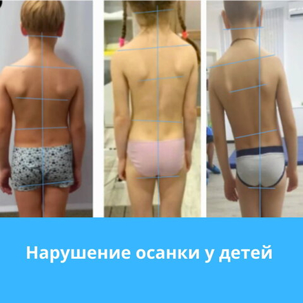 Здоровая спина и осанка (индивидуальные тренировки и семейные группы)