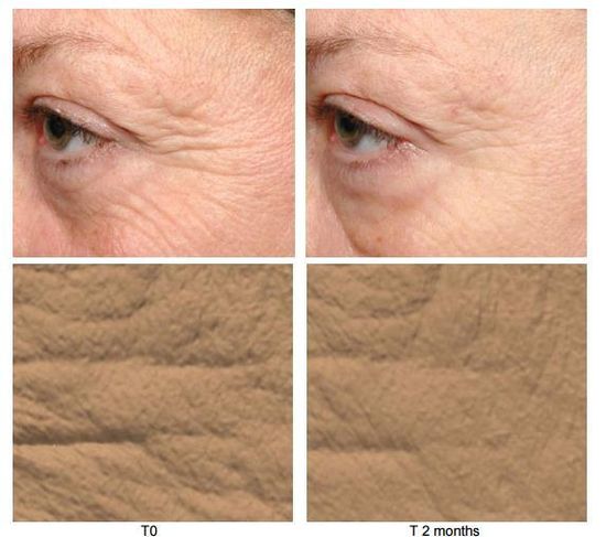 Сыворотка с антивозрастными пептидами с матриксилом