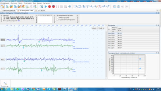 NEURO-MSX DIAGNOSTIC