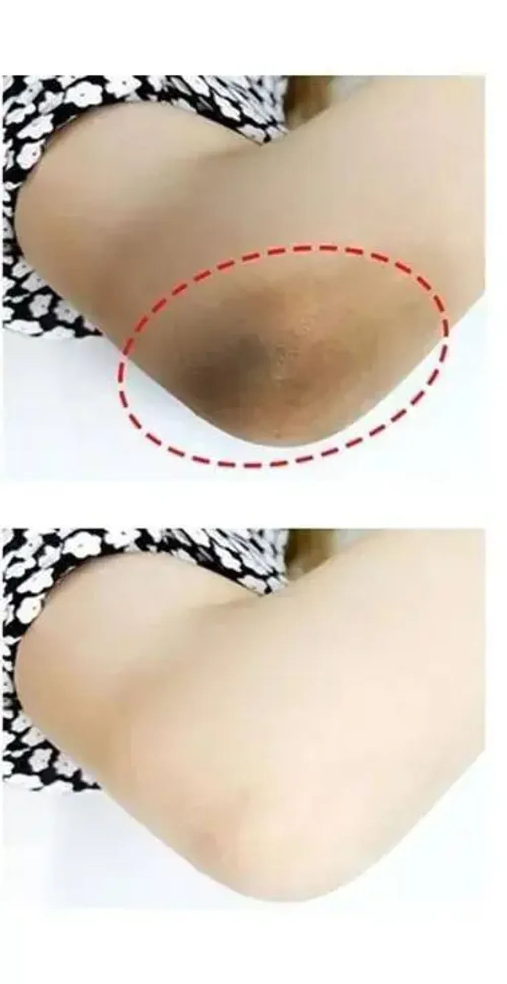 Веганский пилинг-тоник с 7% гликолевой кислоты The Ordinary Glycolic Acid 7% Exfoliating Toner 240 мл.