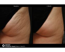 JAN MARINI CELLULITX Высокоэффективный антицеллюлитный крем