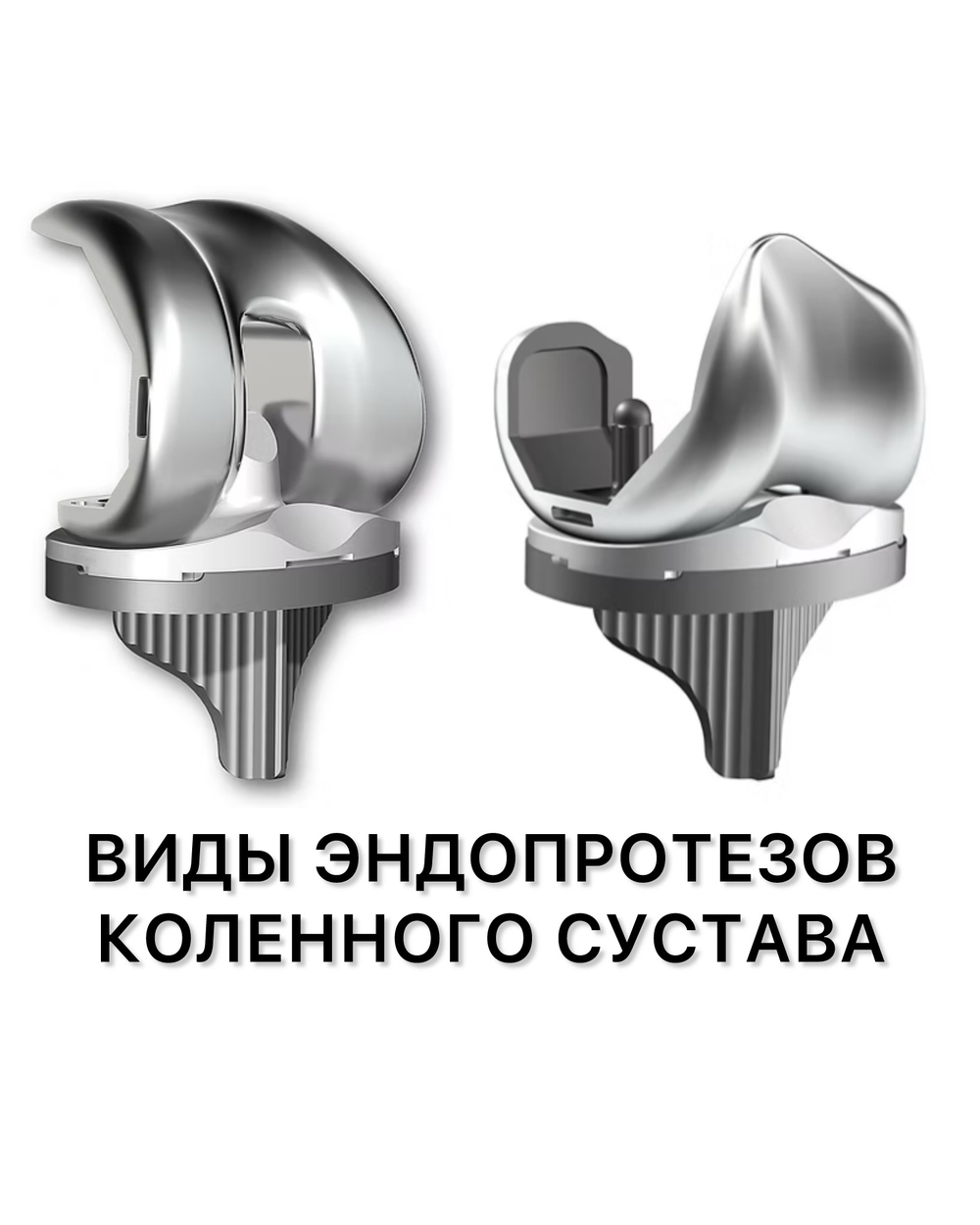 Эндопротез коленного сустава виды