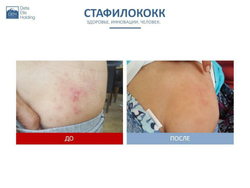 Устройство "DeVita AP + " модель "Mini"