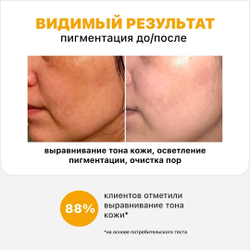 Маска для лица Storyderm кислородная O2 Ecocell White Clean 100 мл