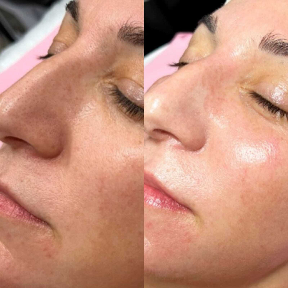 Rejusome | Сыворотка для омоложения кожи лица с экзосомами