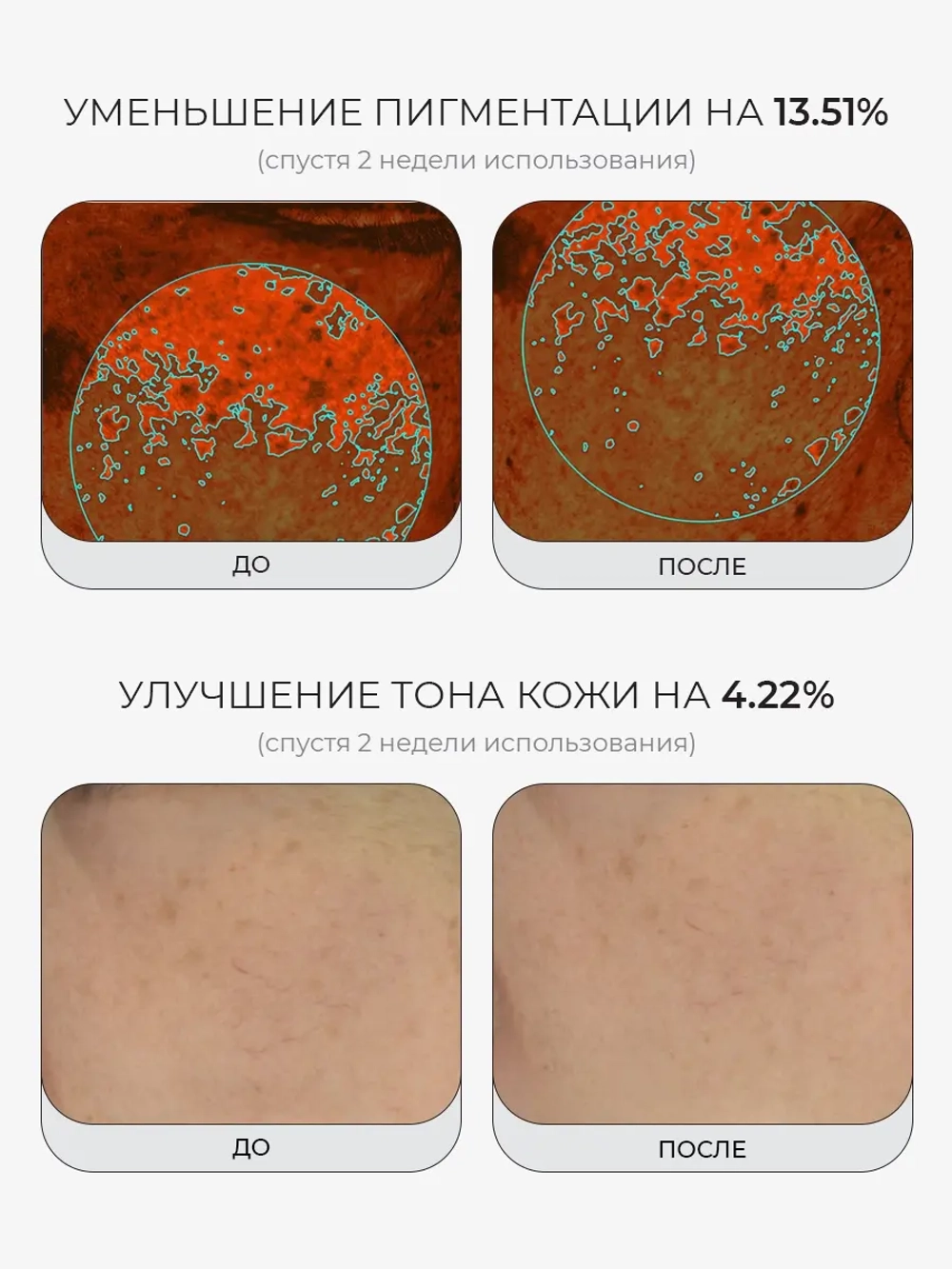 Medicube Успокаивающий тонер с ПДРН и комплексом пептидов PDRN Pink CICA Soothing Toner 250 мл