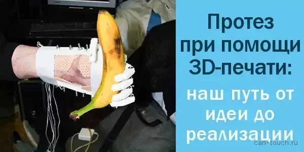 Протез кисти при помощи 3D-печати: наш путь от идеи до реализации