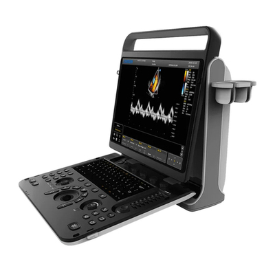 Ультразвуковой аппарат Chison SonoTouch 60 Pro