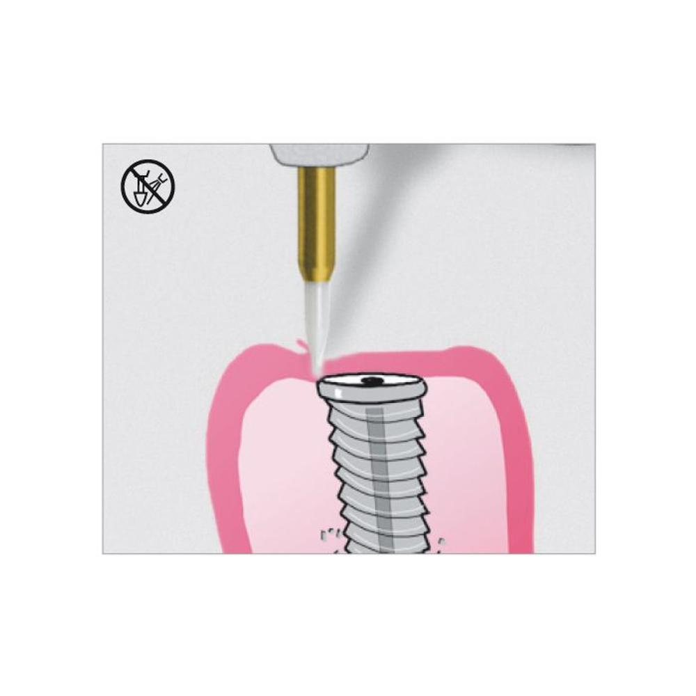 EDENTA STT249.314.016 Хирургический тканевый триммер для операции на мягких тканях полости рта STT249 FG, d 1,6 мм