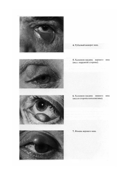 Атлас глазных болезней | Н.А. Пучковская