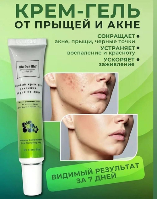 Мазь от акне