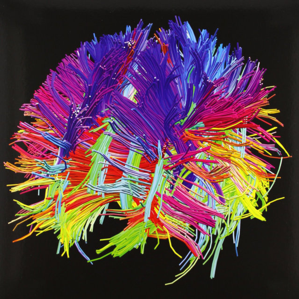 Muse / The 2nd Law (Limited Edition)(2LP+CD+DVD)