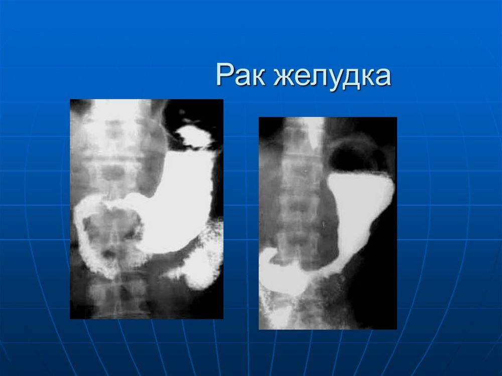 Желудок в разрезе (модель) — купить по ФГОС | Учебный стандарт