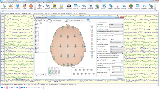 НЕЙРОН-СПЕКТР-4