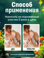ГОМЕОПАТИЧЕСКИЙ БАЛЬЗАМ УРТИКА 25 г