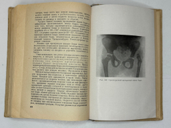 Терновский С. Хирургия детского возраста. М.,  МЕДГИЗ, 1949г.