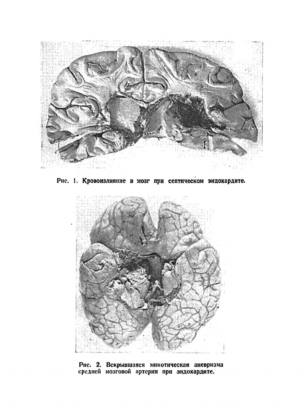 Поражение нервной системы при внутренних болезнях | З.Л. Лурье