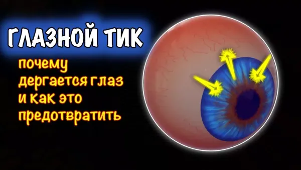 Почему глаза дёргаются? Разбираемся в причинах