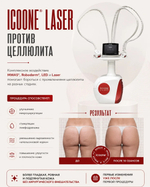 Массаж аппаратный ICOONE LASER