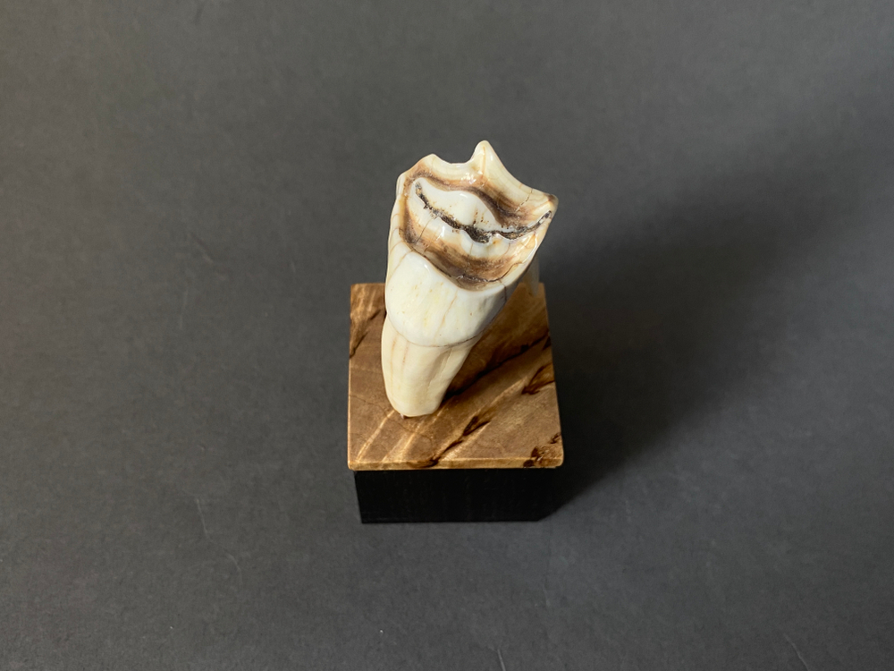 Зуб мудрости