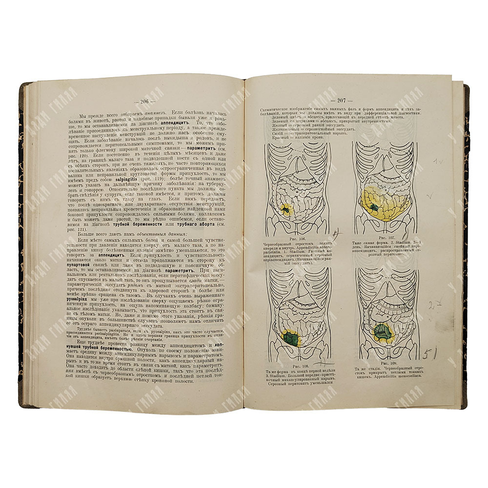 Кервен Ф. [Dr. de Quervain] Частная хирургическая диагностика для студентов и врачей, 1911.