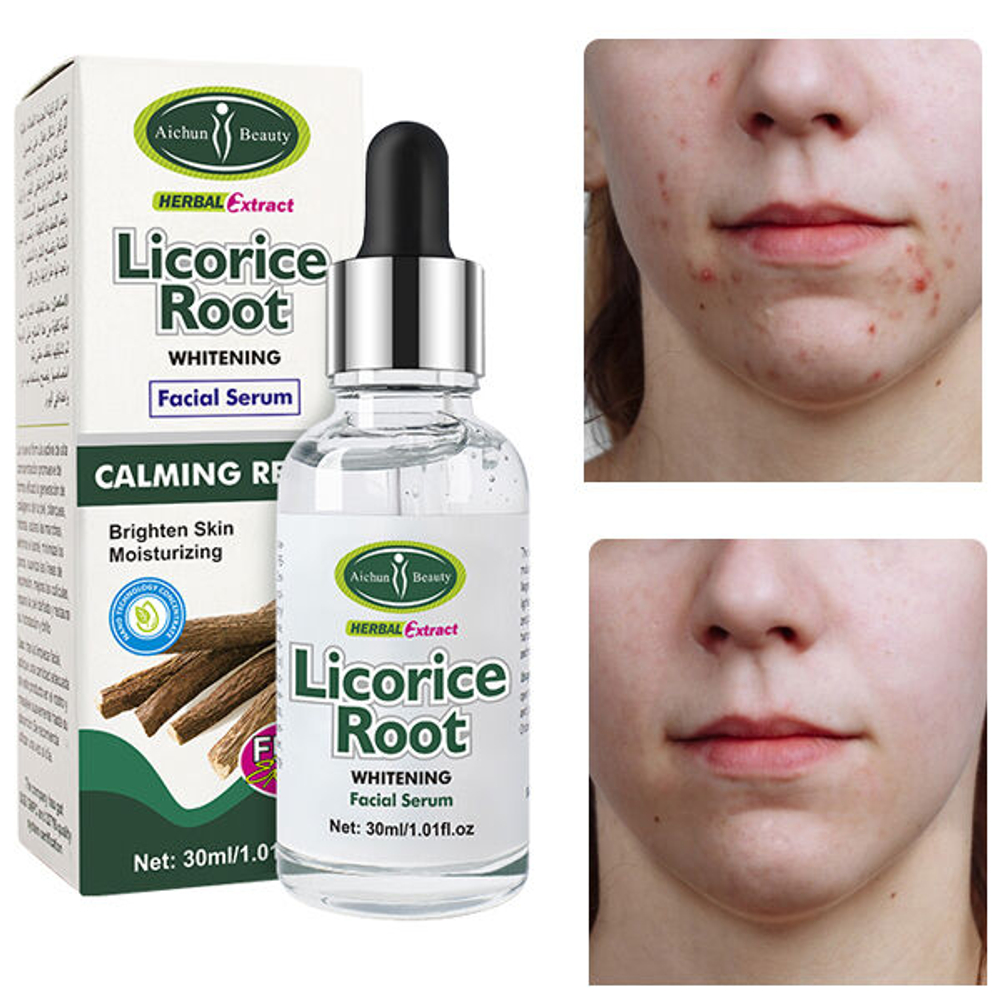 Противовоспалительная сыворотка для лица с экстрактом корня солодки Aichun Beauty Licorice Root Whitening Facial Serum, 30мл