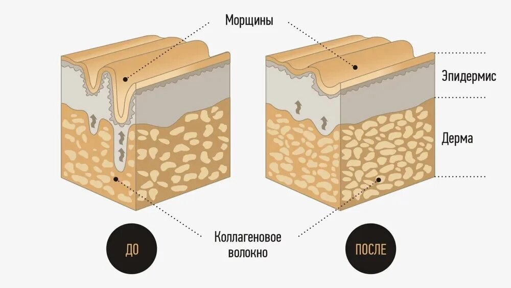 Питьевой коллаген QYRA  кюра с комплексом VERISOL / Collagen QYRA Intensive Care contains VERISOL 21шт по 25 мл германия