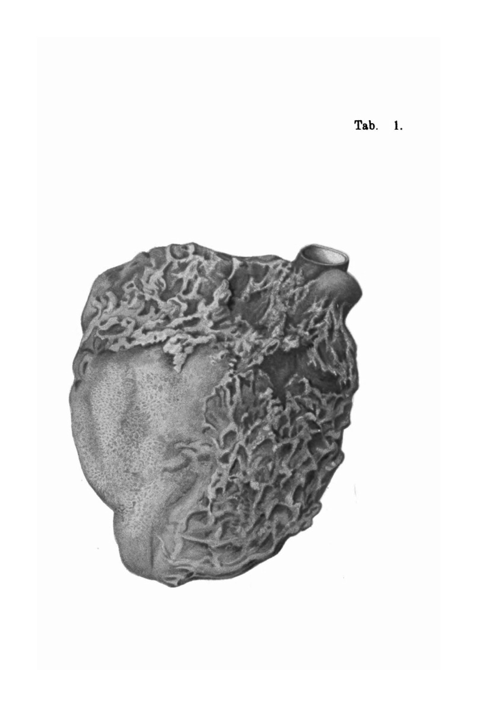 Atlas and Essentials of Pathological Anatomy. Volume 1 | Otto Bollinger