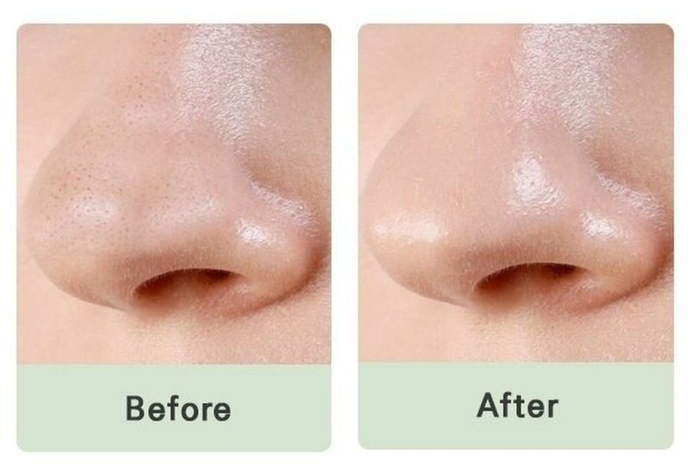 Патчи от черных точек для носа Mizon Pore Fresh Clear Nose Pack