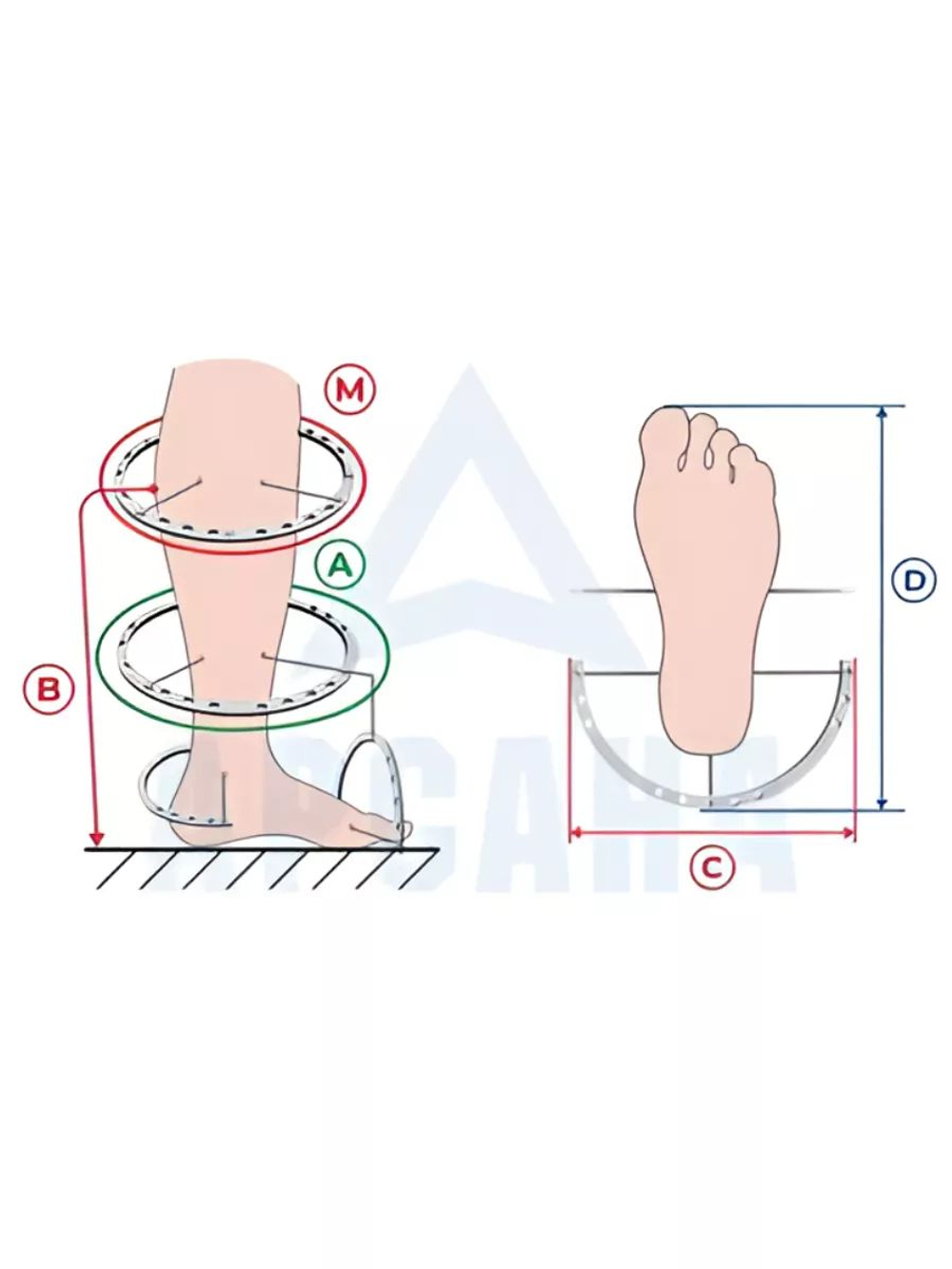 Чехол на холодную зиму (до -30 С) с подошвой из резины на аппарат Илизарова на голени и стопе. ОГСРЗУ-11.
