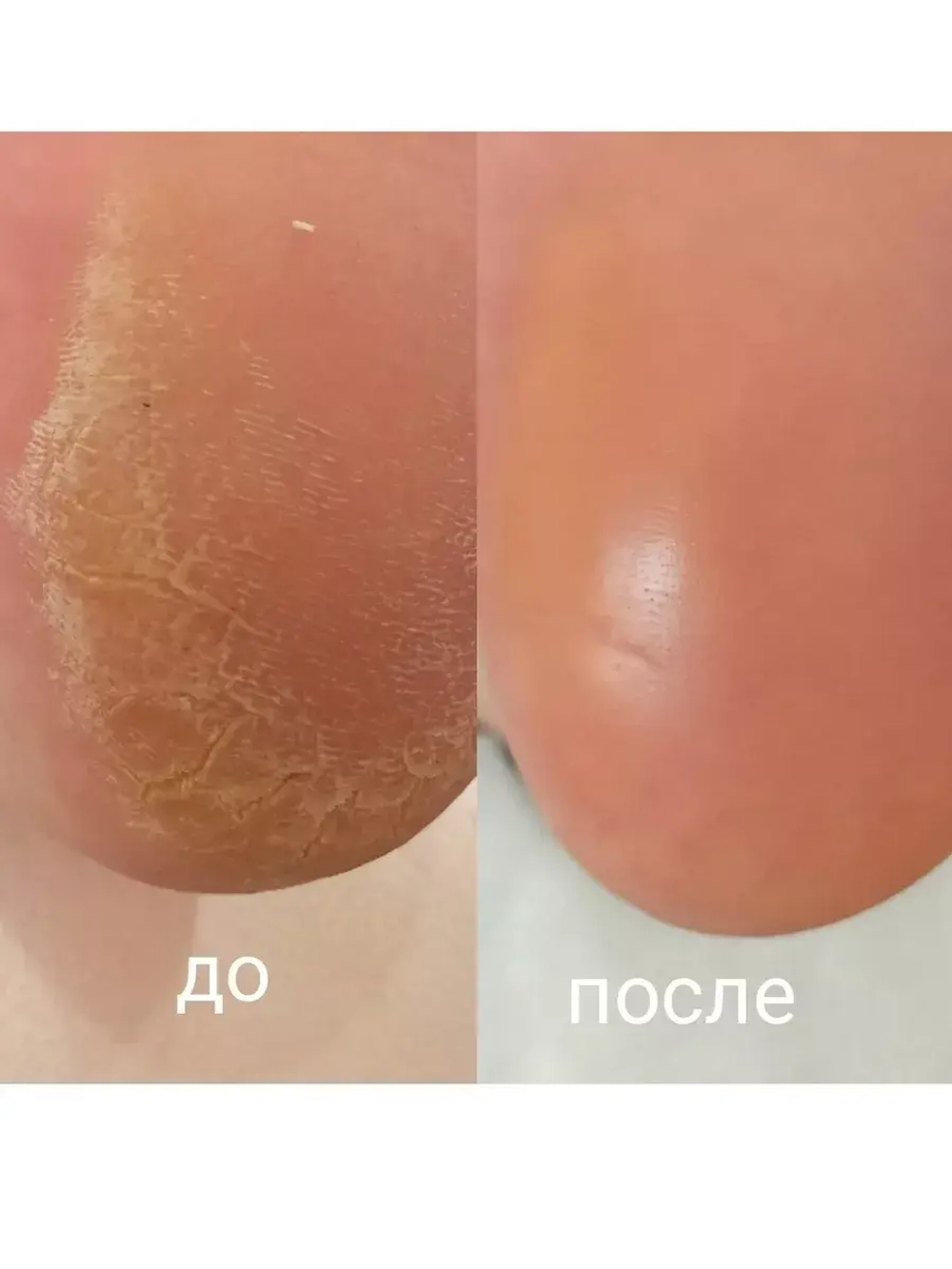 Пилинг носочки для ног педикюрные маска отшелушивающая 3 шт