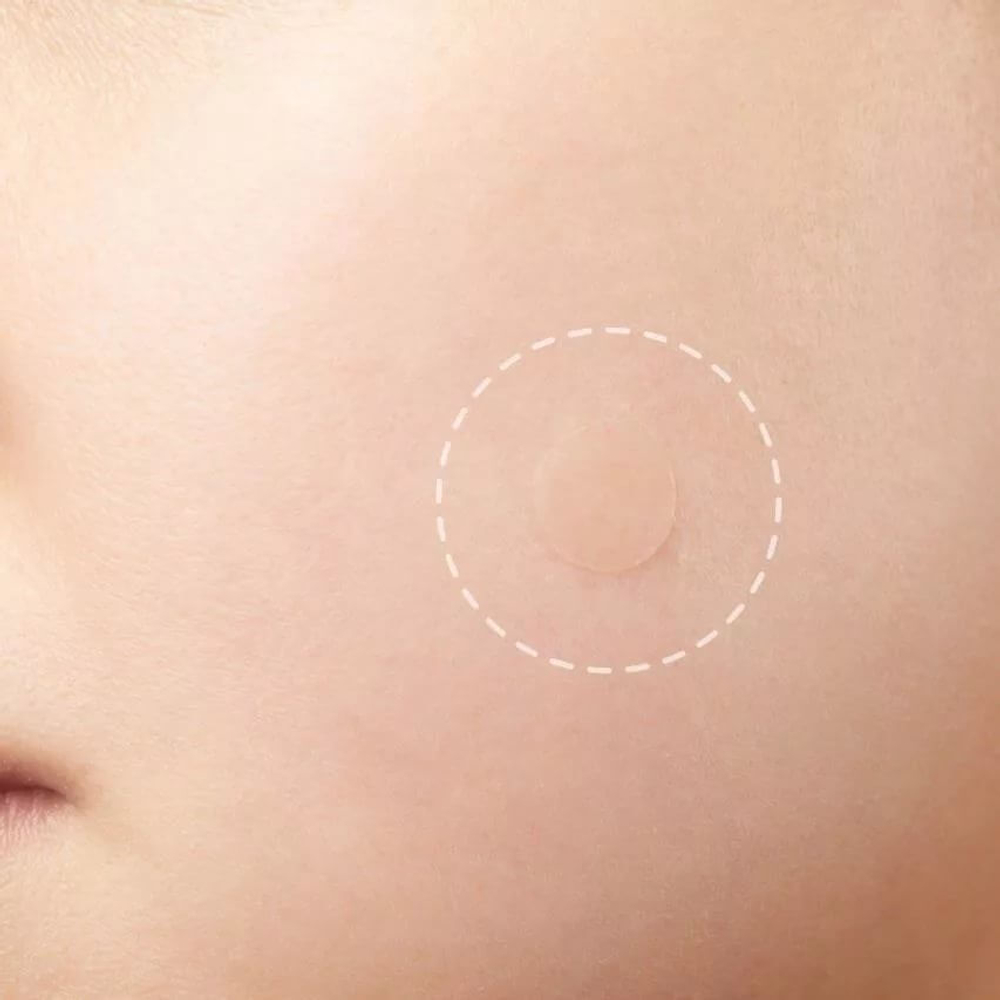 Патчи для проблемной кожи Elizavecca Witch Piggy Hell-Pore Blemish Spot Patch, 44 шт.