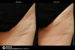 JAN MARINI CELLULITX Высокоэффективный антицеллюлитный крем